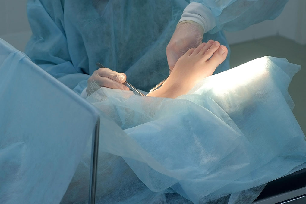 Cirugía mínimamente invasiva del pie caceres-extremadura