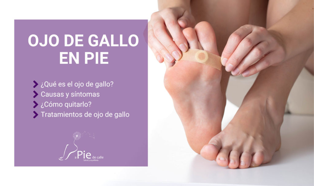 Ojo de gallo pie: Causas y tratamiento